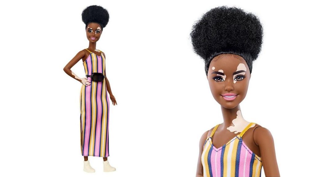 vitiligo barbie